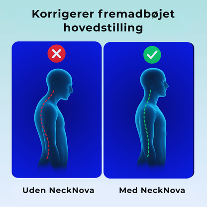 NeckNova - Slip af med nakkesmerter og hovedpine