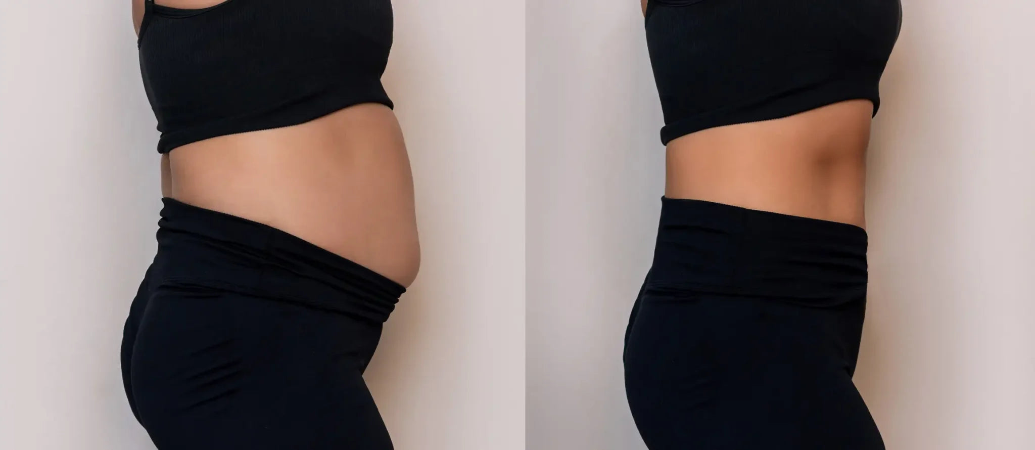 files/Optririse-voor-en-na-suit-EMS-2048x890.webp
